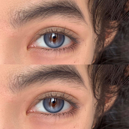 Allecon A19 Blue 貓眼鑽石藍 1 Year 一片裝