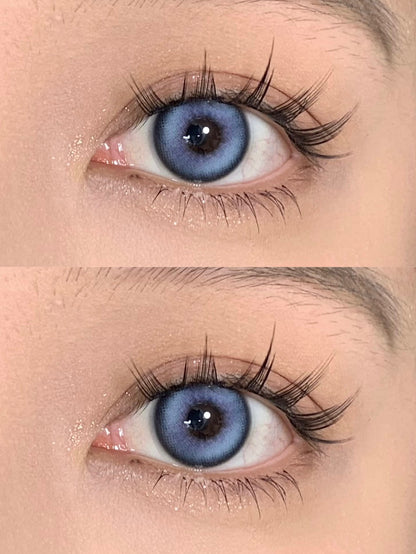 Annieone A1 Blue 發酵氣泡 1 Year 一片裝